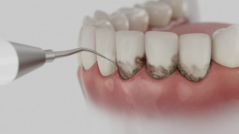 Trusted Wisdom Tooth Removal service in Star City, AR - Dentist Open Now
